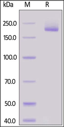 ACROBiosystems Human Siglec-1 / CD169 Protein, His Tag, Quantity: Each