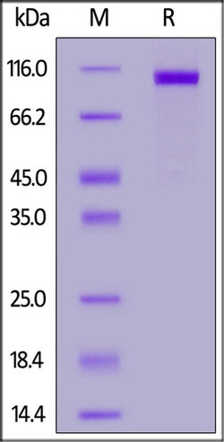 ACROBiosystems ACROBiosystems Biotinylated Human Siglec-2 / CD22 Protein,