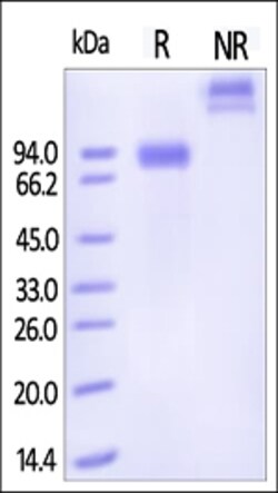 ACROBiosystems ACROBiosystems Human Siglec-6 / CD327 Protein, Fc Tag, Quantity: