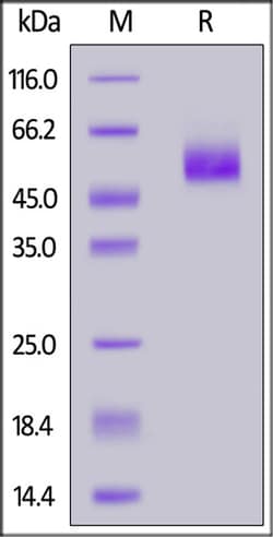 ACROBiosystems ACROBiosystems Human SIRP alphaV8 / CD172a Protein, His