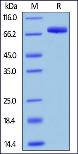 ACROBiosystems ACROBiosystems Human SIRP alpha / CD172a Protein, Fc Tag