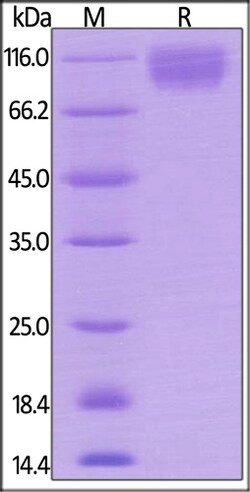 ACROBiosystems ACROBiosystems Mouse SIRP alpha / CD172a Protein, Mouse