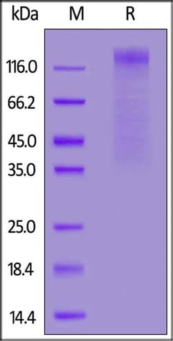 ACROBiosystems HCoV-NL63 S1 protein, His Tag, Quantity: Each of 1