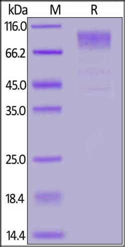 ACROBiosystems HCoV-229E S1 protein, His Tag, Quantity: Each of 1