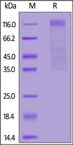 ACROBiosystems HCoV-HKU1(isolate N5) S1 protein, His Tag, Quantity: Each
