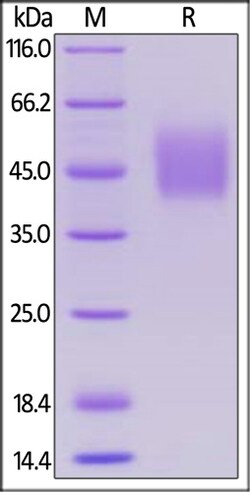ACROBiosystems ACROBiosystems Human SLAMF1 / SLAM / CD150 Protein, His