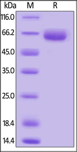 ACROBiosystems ACROBiosystems Mouse SLAMF7 / CRACC / CD319 Protein, Mouse