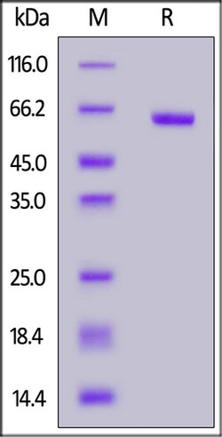 ACROBiosystems ACROBiosystems SARS-CoV-2 S protein RBD (N501Y), Fc Tag