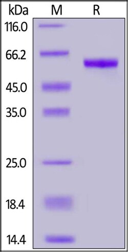 ACROBiosystems 100UG 2019-NCOV COVID-19 S P, Quantity: Each of 1