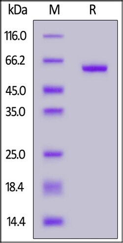 ACROBiosystems ACROBiosystems SARS-CoV-2 S protein RBD (K417T, E484K, N501Y),
