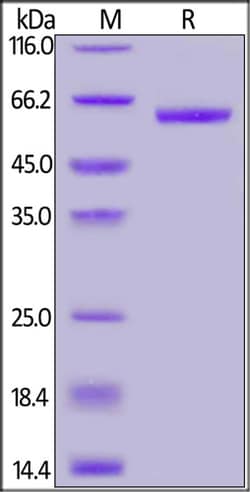 ACROBiosystems 100UG 2019-NCOV COVID-19 S P, Quantity: Each of 1