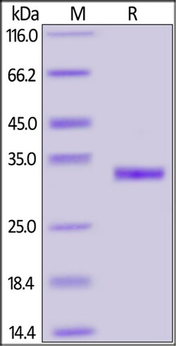 ACROBiosystems 100UG 2019-NCOV COVID-19 S P, Quantity: Each of 1