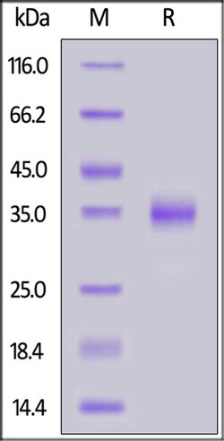 ACROBiosystems ACROBiosystems Biotinylated SARS-CoV-2 S protein RBD (K417N,