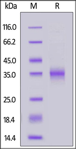 ACROBiosystems ACROBiosystems Biotinylated SARS-CoV-2 S protein RBD (K417T,