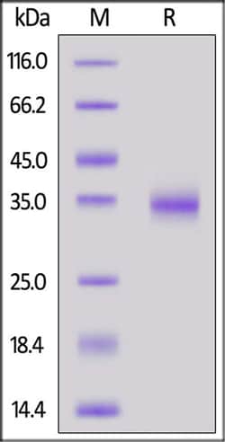 ACROBiosystems ACROBiosystems Biotinylated SARS-CoV-2 Spike RBD (L452R,