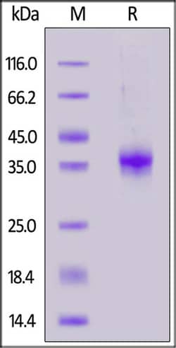 ACROBiosystems ACROBiosystems Biotinylated SARS-CoV-2 Spike RBD (L452R,