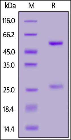 ACROBiosystems ACROBiosystems Anti-SARS-CoV-2 Spike RBD Neutralizing Antibody,