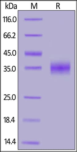 ACROBiosystems 100UG SARS S PROTEIN RBD HIS, Quantity: Each of 1