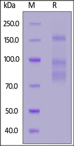 ACROBiosystems ACROBiosystems SARS-CoV-2 S protein (F817P, A892P, A899P,