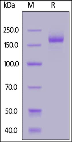 ACROBiosystems ACROBiosystems SARS-CoV-2 S protein (L18F, D80A, D215G,