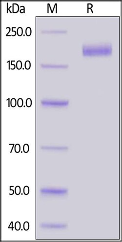 ACROBiosystems RECOMBINANT PROTEIN 25UG BIOTI, Quantity: Each of 1