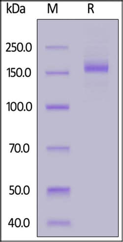 ACROBiosystems ACROBiosystems Biotinylated SARS-CoV-2 Spike Trimer (P26S,