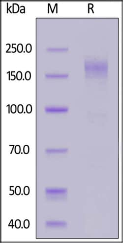 ACROBiosystems ACROBiosystems HCoV-229E Spike protein, His Tag, Quantity: