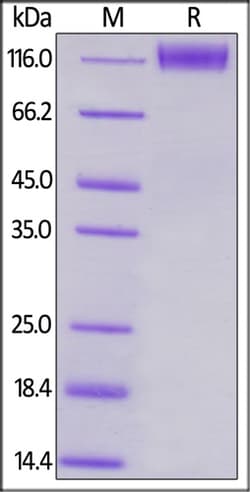 ACROBiosystems ACROBiosystems Human CD96 / TACTILE Protein, Mouse IgG2a