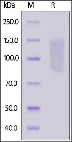 ACROBiosystems ACROBiosystems Human CD96 / TACTILE (C110S) Protein, His