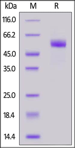 ACROBiosystems ACROBiosystems Human TACI / TNFRSF13B (R119A, R122A) Protein,