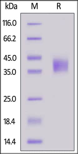 ACROBiosystems ACROBiosystems Cynomolgus Coagulation Factor III / Tissue
