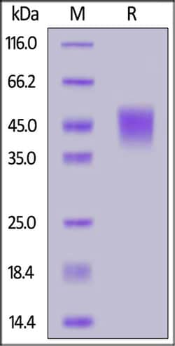 ACROBiosystems ACROBiosystems Mouse Coagulation Factor III / Tissue Factor