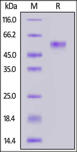 ACROBiosystems ACROBiosystems Human Coagulation factor VII / F7 Protein,