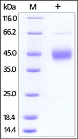 ACROBiosystems Human TFPI Protein, His Tag
