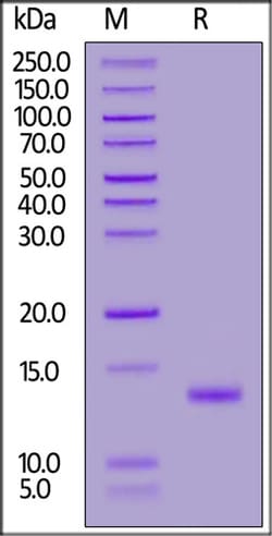 ACROBiosystems Mouse TGF-Beta 1 / TGFB1 Protein, Quantity: Each of 1
