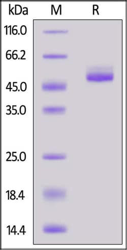 ACROBiosystems ACROBiosystems Cynomolgus / Rhesus macaque TIGIT Protein,