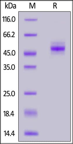ACROBiosystems ACROBiosystems Biotinylated Human TIGIT Protein, Mouse IgG2a