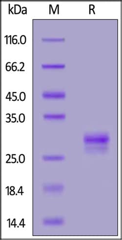 ACROBiosystems ACROBiosystems Human TL1A / TNFSF15 Protein, His Tag (MALS