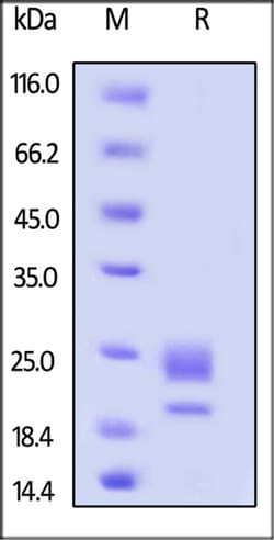 ACROBiosystems ACROBiosystems Mouse OX40 Ligand / TNFSF4 Protein, His Tag,