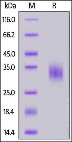 ACROBiosystems ACROBiosystems Human DR3 / TNFRSF25 Protein, His Tag, Quantity: