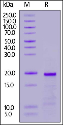 ACROBiosystems Human TOP2A / TOP2 Protein, Tag Free, Quantity: Each of