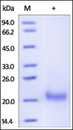 ACROBiosystems ACROBiosystems Human TRAIL R1 / DR4 / TNFRSF10A Protein,