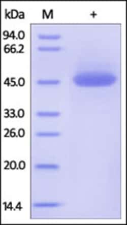 ACROBiosystems ACROBiosystems Human TRAIL R1 / DR4 / TNFRSF10A Protein,