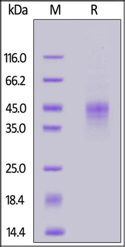 ACROBiosystems ACROBiosystems Canine TROP-2 / TACSTD2 Protein, His Tag,