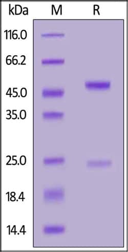 ACROBiosystems ACROBiosystems Anti-Trastuzumab Antibodies (recommended