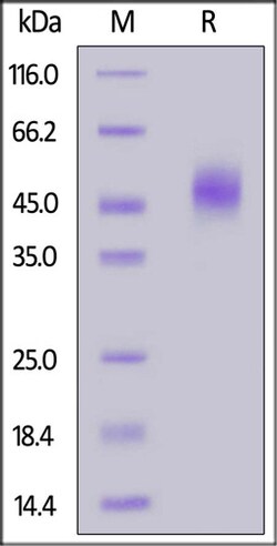 ACROBiosystems ACROBiosystems FITC-Labeled Human uPAR / PLAUR Protein,