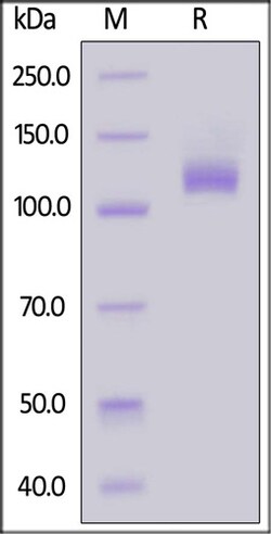 ACROBiosystems ACROBiosystems Human VCAM-1 / CD106 Protein, Fc Tag (MALS