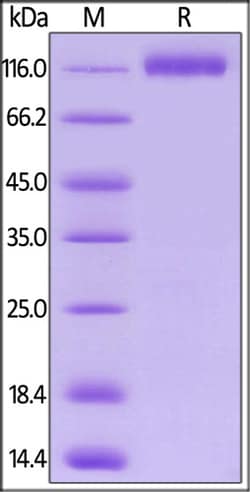 ACROBiosystems ACROBiosystems Biotinylated Human VEGF R1 / Flt-1 Protein,