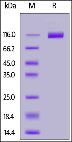 ACROBiosystems FITC-Labeled Human VEGF R2 / KDR Protein, His Tag | Buy Online | ACROBiosystems | Fisher Scientific