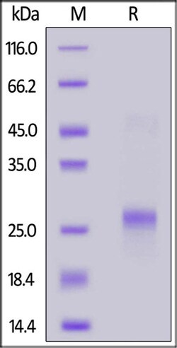 ACROBiosystems ACROBiosystems FITC-Labeled Human VEGF165 Protein, His Tag,